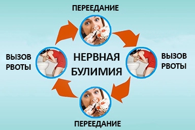 Лечение булимии в Парковом